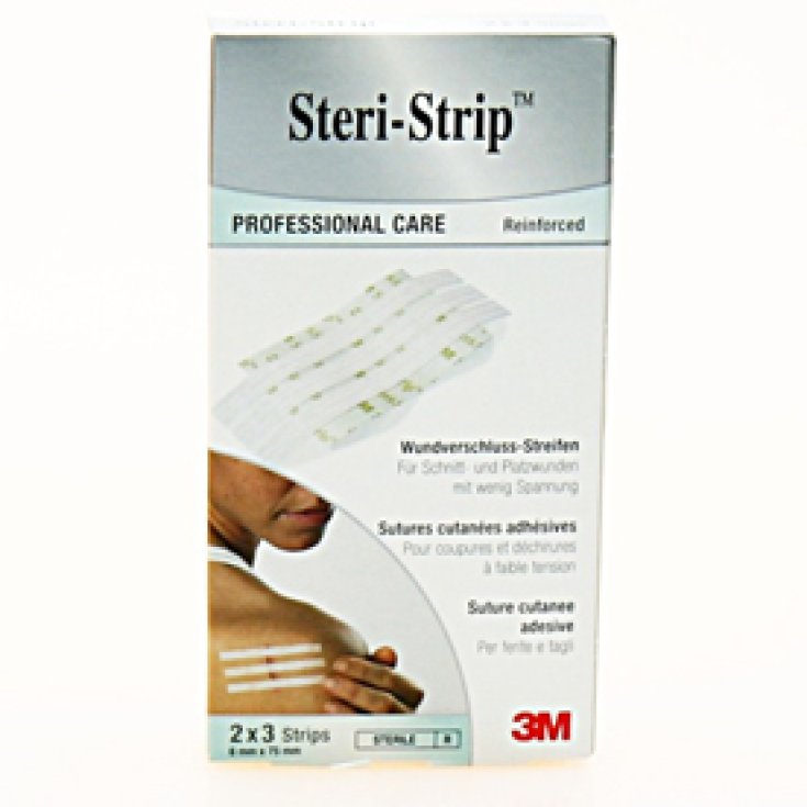 Steristrip 3m 6x75mm 6uds