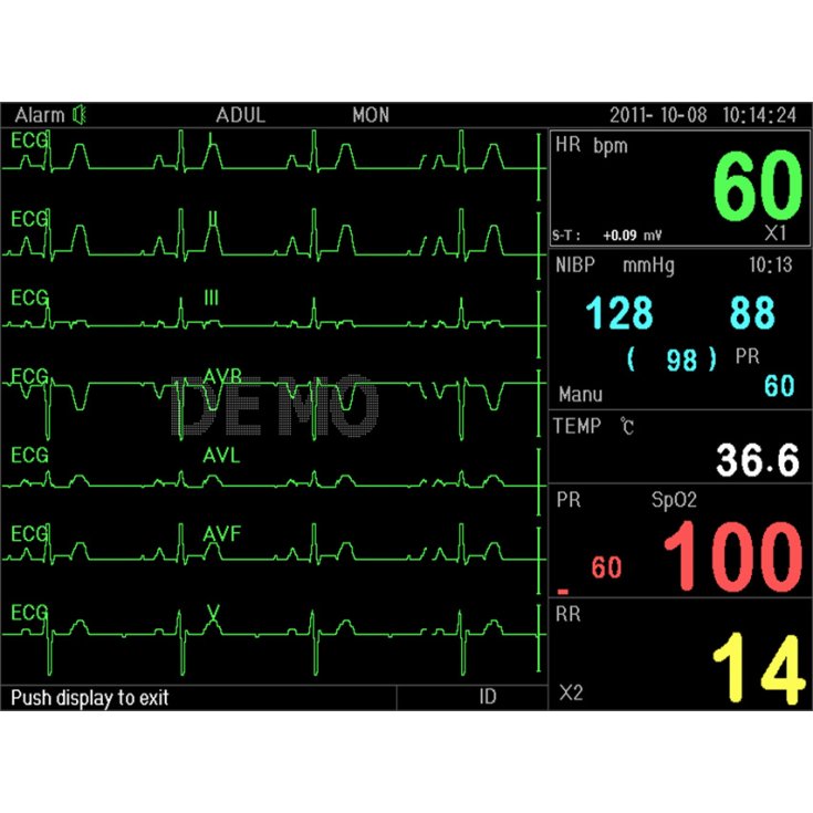 P16 MONITOR MULTIPARAM PC3000